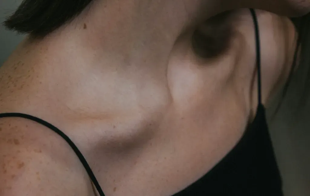 Profesjonalne sposoby na przebarwienia posłoneczne skóry